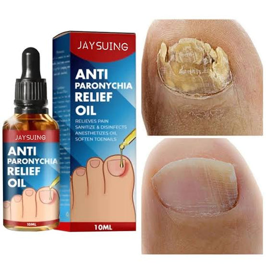 ELIMINA HONGOS PARA UÑAS